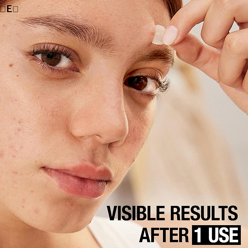 Beauty Zone Makeup - 〔E〕360Pcs Invisible Pimple Removal Anti-Acne Hydrocolloid